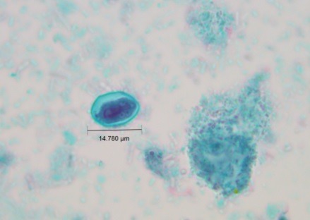 Comprehensive Gastro-Intestinal Solutions -Replace Ova _ Parasites, Wet Mount _ Concentrated Permanent Trichrome Stain