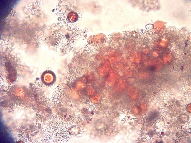 Traditional Stool Tests Genesis Labs