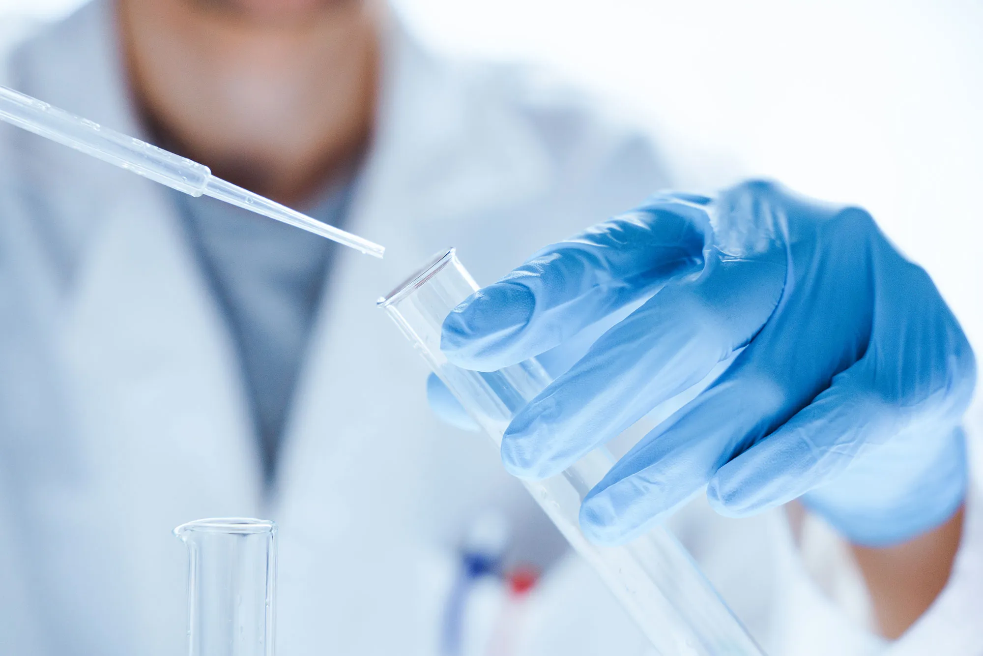 genesis-labs-about-us-img-2 Microbiological research with a test tube and micropipette in hands of a laboratory worker in close-up
