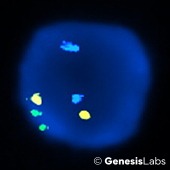 terc-negative terc-negative