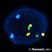 terc-single-gain terc-single-gain